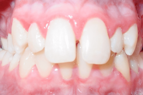 Variety of Teeth
