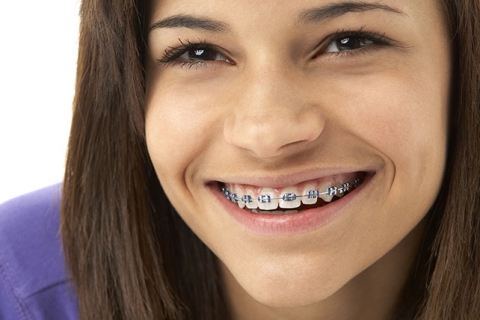 3 Braces Tips from Your Local Orthodontist